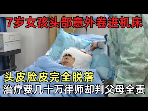 7岁女孩惨遭不幸, 头部卷入工厂机床头皮脸皮完全脱落, 律师却判父母全责?｜奇闻