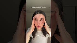 From Pain to Clear Skin – My Honest Acne Journey #skincare #acnefree