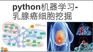 python机器学习乳腺癌数据挖掘
