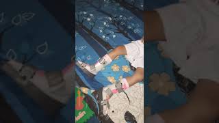 Short ‼ Anak Cerebral Palsy bangun tidur terapi sepatu AFO - Story AQILA