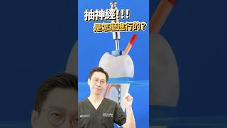 抽神經😱醫師說不會痛？是騙人的吧！#抽神經 #根管治療