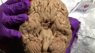 Ventral Surface of the Cerebral Hemisphere