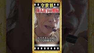 世界で症例20人以下の難病を患う女性 #雑学 #shorts