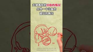 高血压以后脑动脉硬化，血管破了能恢复正常吗？#中医 #健康