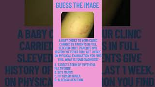 Guess the image #tooth #neetmdslectures #exam #dentalexam