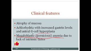 Stomach| Pathoma Videos| Pathology| #pathoma #mednex