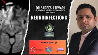 Sarbesh Tiwari | NeuroInfections - Case Based Reviews