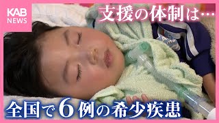 全国で同じ症例は6例… 希少疾患の子どもと家族 支援の体制は？【世界希少・難治性疾患の日】