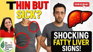 🌿 Thin Outside, Fatty Liver Inside? Shocking Signs You’re Missing!✨