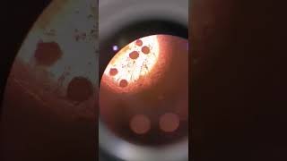 Molds under the microscope #laboratory #microscope #mls #cls #biology #mold #underthemicroscope