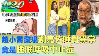 趙小喬發現劉亮佐睡覺不對勁 竟是睡眠呼吸中止症 健康2.0