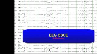 EEG OSCE
