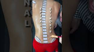 The Best Exercise for Sciatica