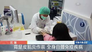 少女手腳無力輪椅代步 竟是皮肌炎作祟