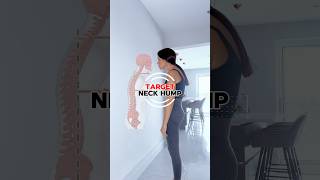IYTL exercise for neck hump and  posture fix ‼️ #neckhump #backpainrelief #physio #correctposture