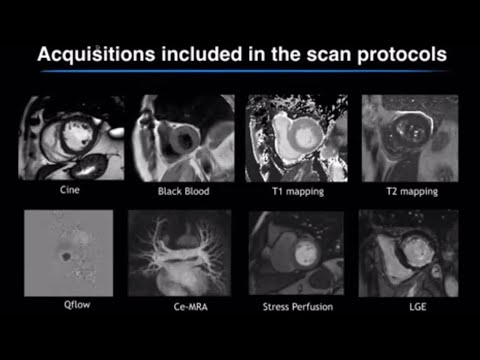 Helium Free Cardiac MR5300 1.5Tesla Wide bore MRI- Helium free MRI