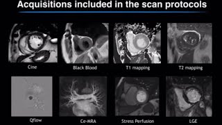 Helium Free Cardiac MR5300 1.5Tesla Wide bore MRI- Helium free MRI