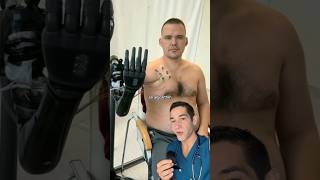 Doctor Reacts: advanced medical prosthetics