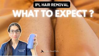 How to use Ulike Air at-home IPL Device? - Qs Answered I Dr. Sanober Pezad Doctor