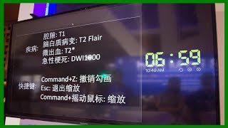 “人機大戰”強勢來襲！神經科醫生能否戰勝人工智能？