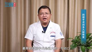 【斜视】斜视手术后多久能恢复