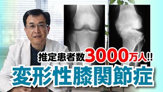 【変形性膝関節症】原因・予防・保存的と手術的治療について現役整形外科医が解説