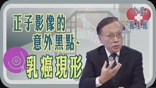【大愛醫生館】 正子影像的意外黑點 - 乳癌現形 20250728