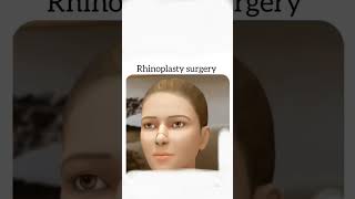 #Rhinoplasty surgery💉💊🩺..... ||
