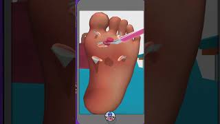 ASMR FEET ANIMATION VIDEOS TREATMENT  #asmr #youtubeshort #shorts #shortsvideo #brainasmr