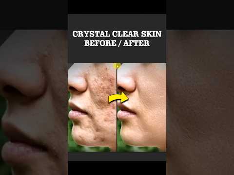 How Adobe Photoshop | Clear Skin in 1 Minute – Easy Retouching for Beginners