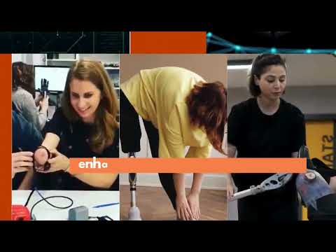AI-Powered Bionic Limbs: Transforming Lives & Restoring Independence | Cogent Innovations