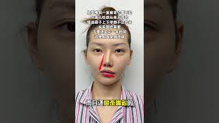 感谢上海艾美，把我多年的歪鼻嘴斜都给调整好了 #medical #上海 #整形 #变美小技巧
