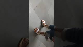 "Step Toward Straight Feet👣#CTEV#Clubfoot#CTEVTreatment #ClubfootCorrection#JaaharOrtho#CTEVBrace