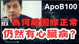 還在檢查膽固醇？apoB100 才是心臟病的主要元兇