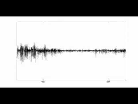 Brain Tsunami, spreading depolarization, traumatic brain injury, TBI