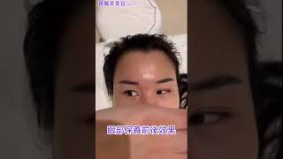 眼壓高眼睛疲勞、黑眼圈做完眼部保養以後黑眼圈改善很多三重做臉寶麗萊美容Spa