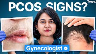 OBGYN Debunks 14 Popular PCOS & PCOD Myths!