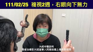 滑車神經問題引起複視，針灸11次恢復正常（雙眼複視）