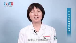 【口腔科】门牙中间有缝怎么办