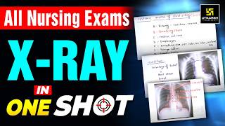 X-Ray in One Shot | Important for All Nursing Exams | Utkarsh Nursing Classes