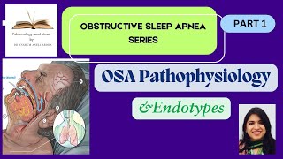 OSA Series Part 1: Pathophysiology and Endotypes of Obstructive Sleep Apnea