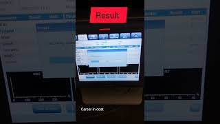 #3partanalyzer#cbcanalyzer#hematology #labtechnician #medicallab #labprocedure#bloodsample #mlt