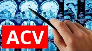 😨 ¡¡Conoce TODO de los ACV!! | TECH Universidad Tecnológica @techuniversidad
