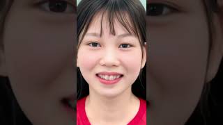 Flex các đồng niềng tháng 3 tại Nha Khoa Toàn Cầu #toancau #nhakhoathammytoancau #niengrangmaccai