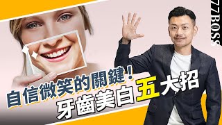 牙齒美白5招，哪種最便宜，哪種效果好？貼片真的值得做！？【77老大】