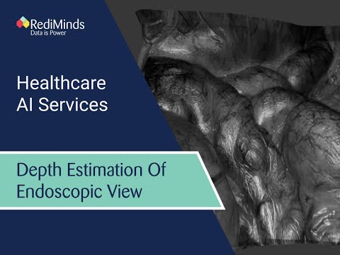 Depth Estimation of Endoscopic View