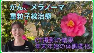 がん、メラノーマ、粘膜性悪性黒色腫、重粒子線治療