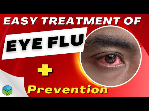 All About Eye Flu: Recognizing Symptoms And Effective Treatments | 1Stop Health