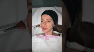 #chemicalpeels 🔥🩵 #dermatologistskincare #skindoctor