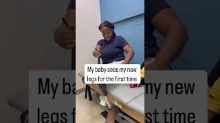 My baby seeing my new prosthetic legs for the first time